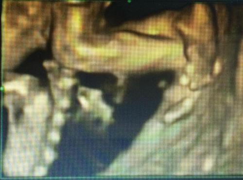 cddbe423fd40b107med.jpg